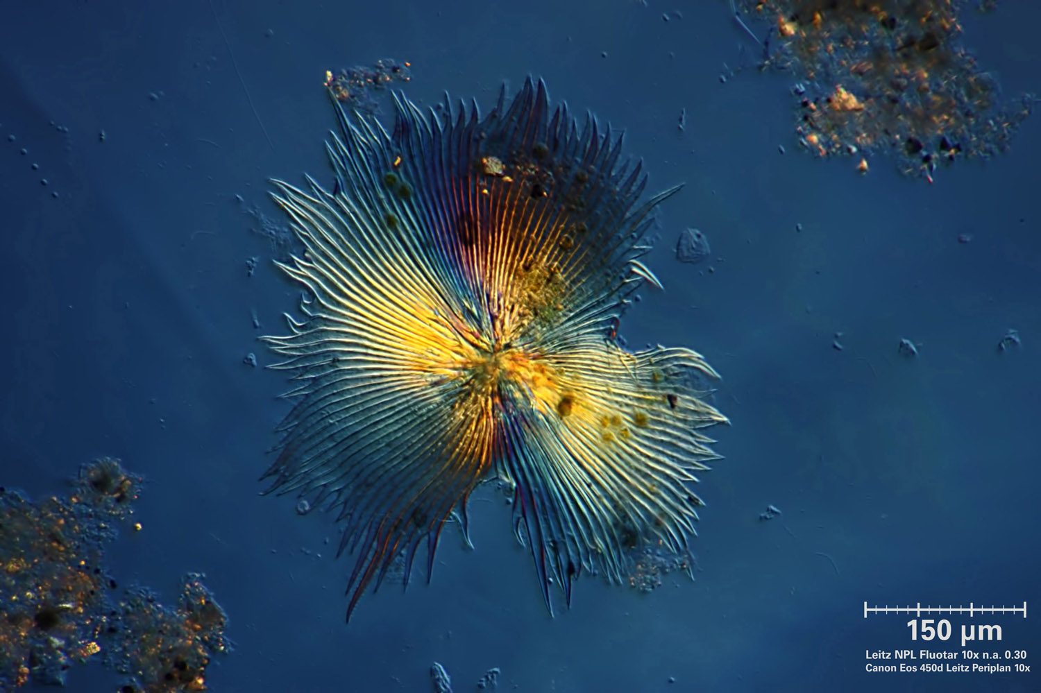 vorticella?